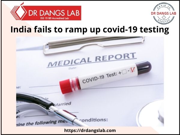 covid testing | Dr Dangs Lab